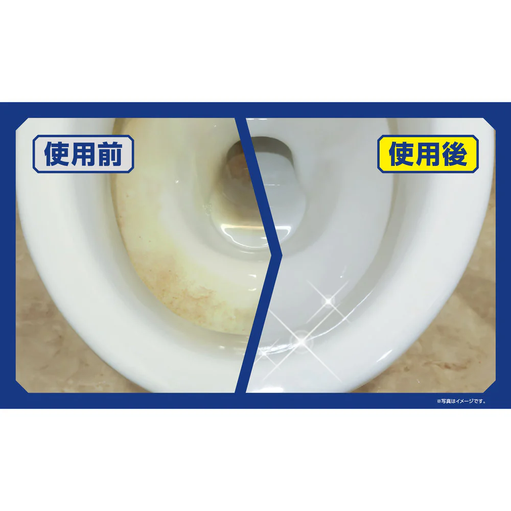 アイオン (新津春子)トイレの黄ばみ尿石洗浄剤ジェルタイプ - Image 2