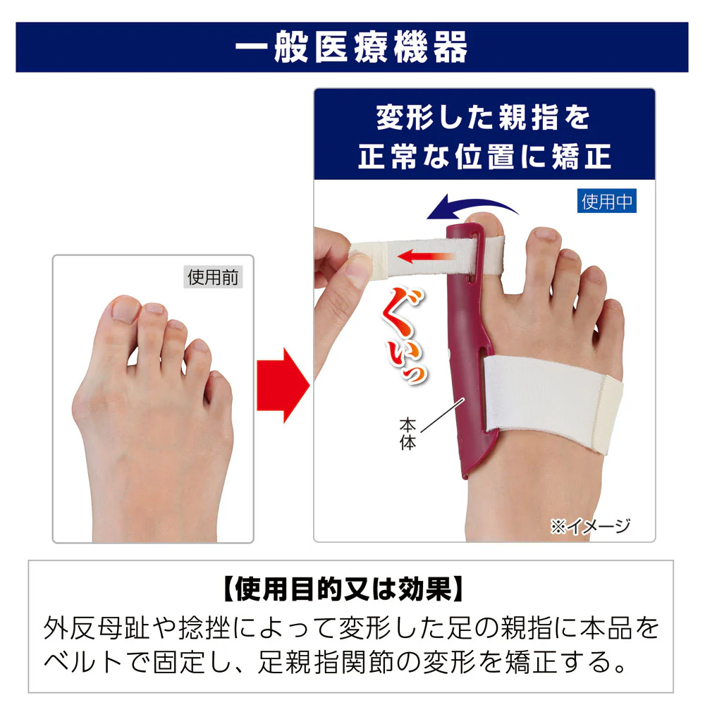 【一般医療機器】サイプラス プラスウォーク 外反母趾矯正プロテクター 右足用 1個 - Image 3