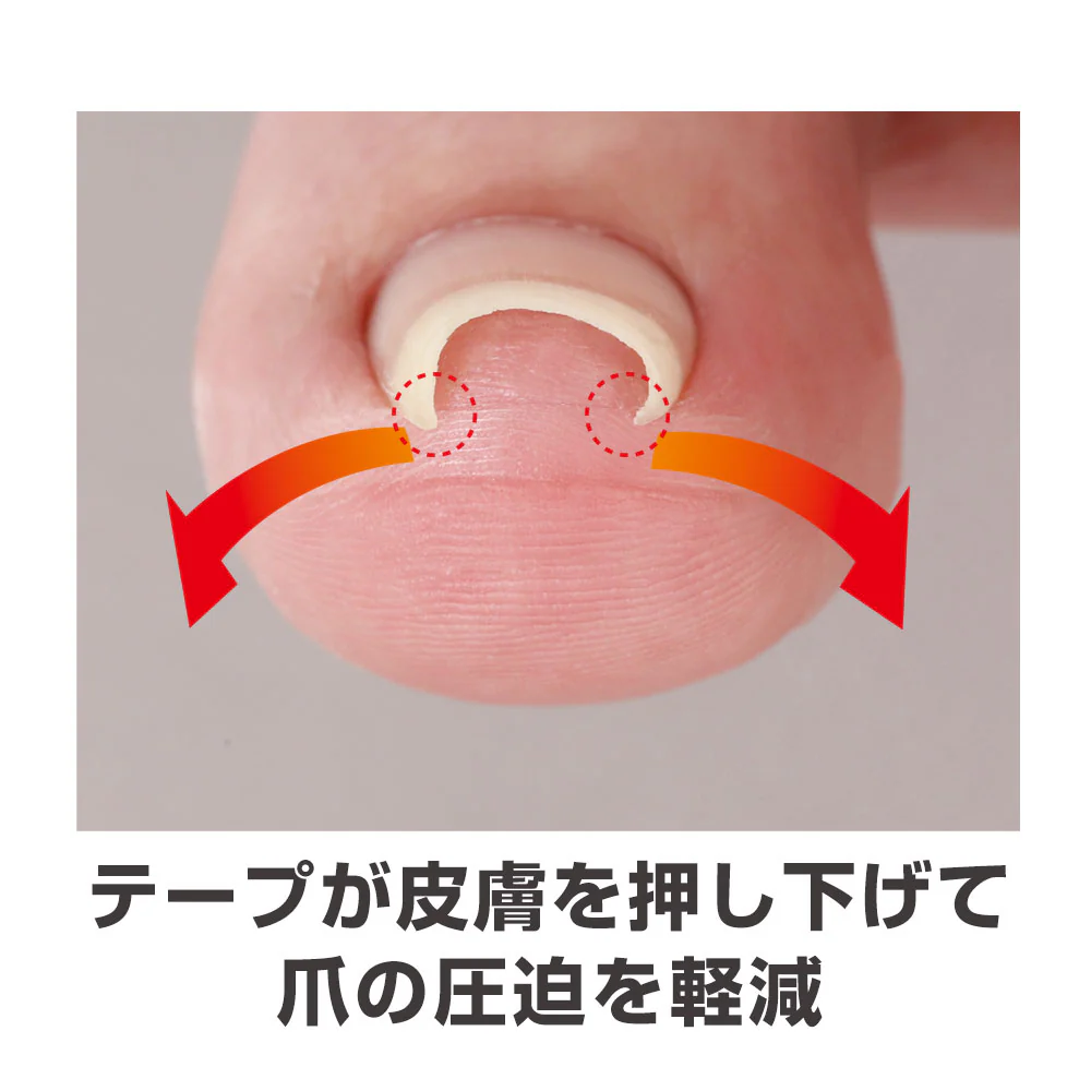 サイプラス 透明巻き爪テープ ミエーヌ 10枚 - Image 3