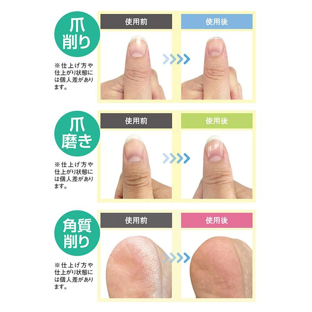 電動爪削り&角質ケアローラー 【直送品】 返品・キャンセル・他商品と同時購入は不可 - Image 4
