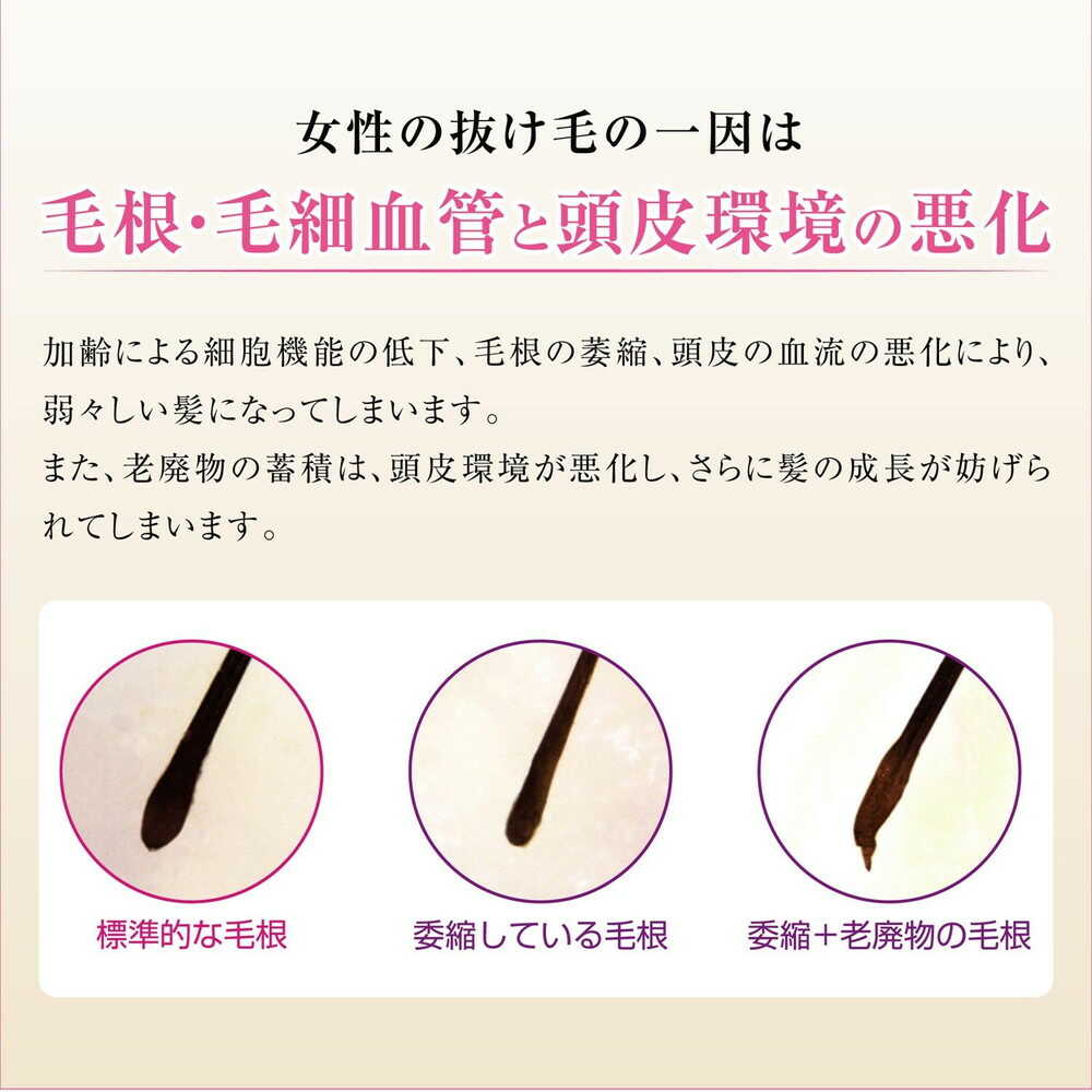 【医薬部外品】加美乃素本舗 薬用レディース加美乃素EX 無香料 150ml - Image 3